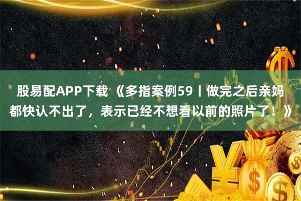 股易配APP下载 《多指案例59丨做完之后亲妈都快认不出了，表示已经不想看以前的照片了！》